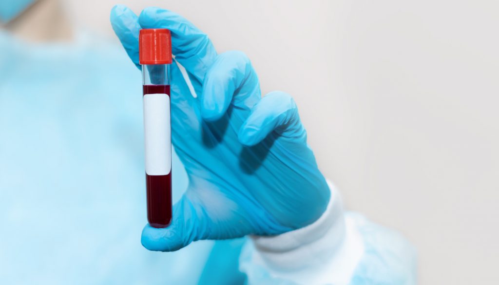 Check Up Anemia Base Laboratorio Analisi CR